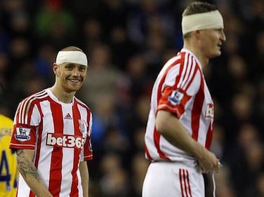 Rooney, le foto dell'infortunio e la satira sul web 3
