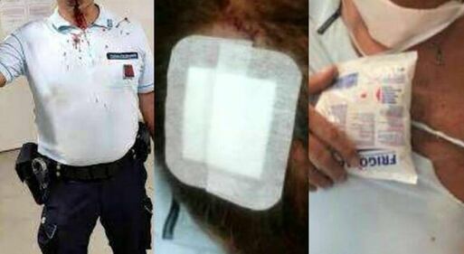 Le foto degli agenti picchiati dai detenuti nelle carceri 5