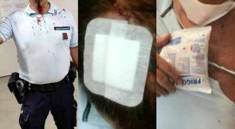 Le foto degli agenti picchiati dai detenuti nelle carceri 5