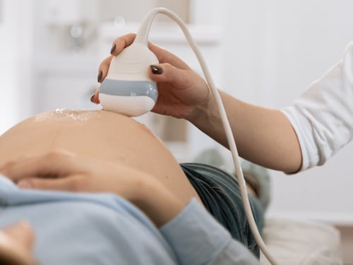 Ungheria choc sull'aborto. Obbligatorio per le donne ascoltare i battiti del feto