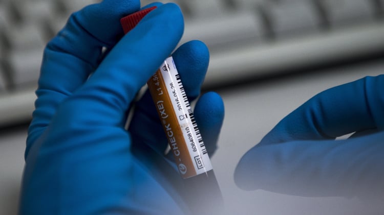 Milano-Cortina, come funziona con i controlli antidoping