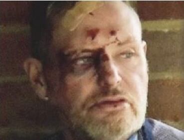 Gascoigne: "Sobrio da un anno". Ma una foto lo smentisce 1