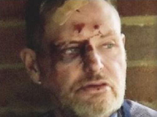 Gascoigne: "Sobrio da un anno". Ma una foto lo smentisce