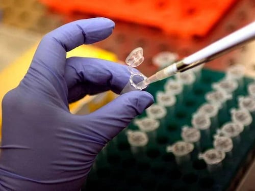 Morbillo, Pennsylvania segnala sesto morto: 39enne con patologie e già infettata di recente