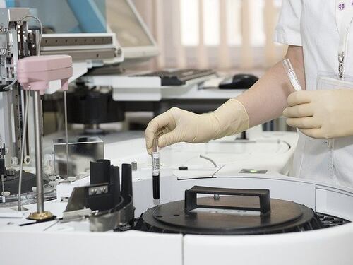 Linfoma di Hodgkin, le varianti genetiche ereditarie aumentano il rischio