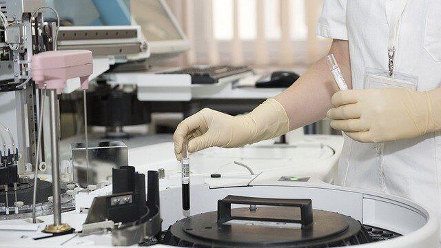 Linfoma di Hodgkin, le varianti genetiche ereditarie aumentano il rischio