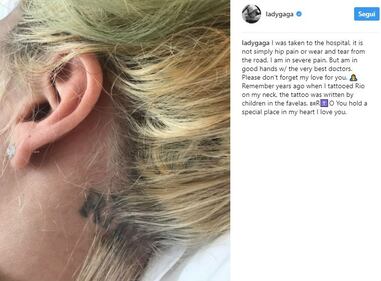 Lady Gaga, le immagini più famose 5