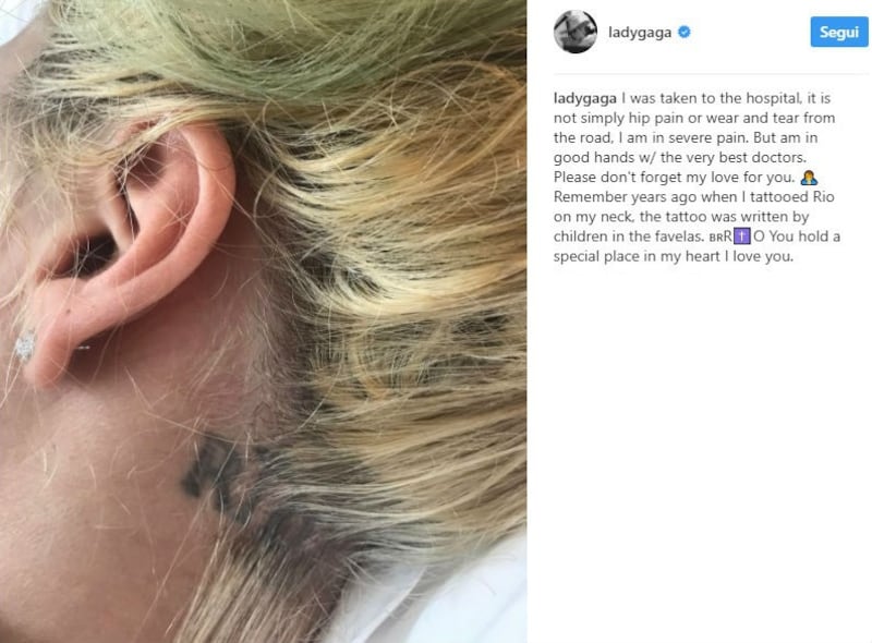 Lady Gaga, le immagini più famose 5