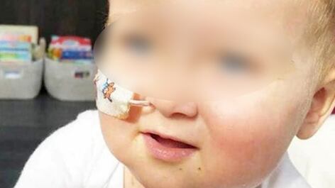 Alex operato al Bambino Gesù, il donatore per il trapianto è il padre