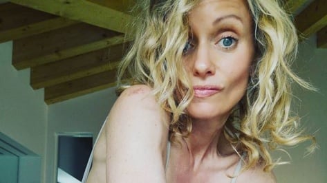 Justine Mattera piena di lividi sui social: "Ma si può a 48 anni!?"
