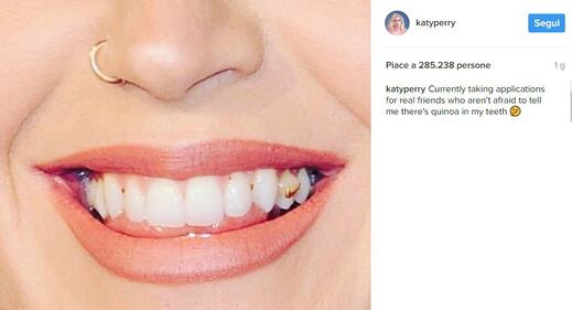Katy Perry: denti sporchi sul red carpet 2