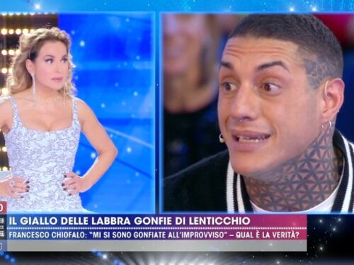 Francesco Chiofalo: "Le labbra gonfie per un'allergia, ma pensano sia rifatto perché sono bello"