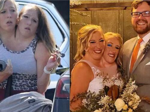 Abby e Brittany Hensel: le gemelle siamesi diventano mamme, ma chi è la madre biologica?