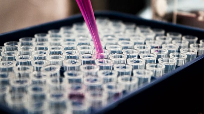 Tumori, nuova terapia aumenta tasso sopravvivenza per cancro a polmoni