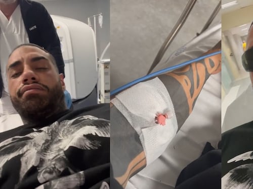 "Non ci vedo bene". Francesco Chiofalo in ospedale dopo l'intervento per cambiare colore agli occhi