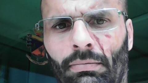 Pavia, gli occupano il box e poi lo pestano a sangue
