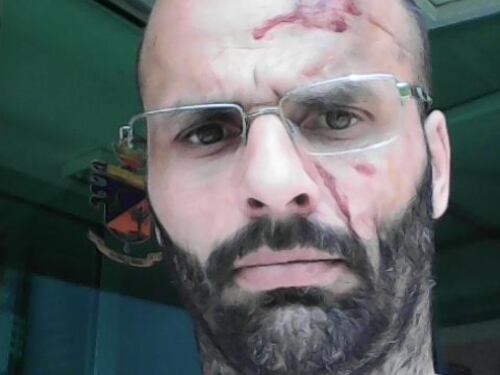 Pavia, gli occupano il box e poi lo pestano a sangue