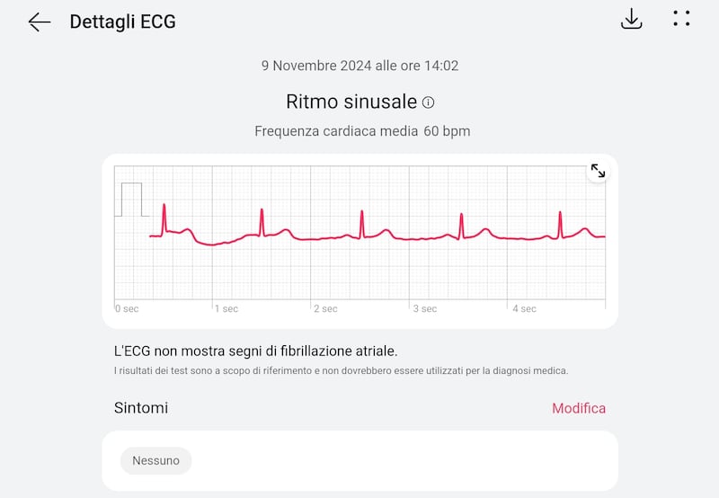 ECG Huawei Watch D2