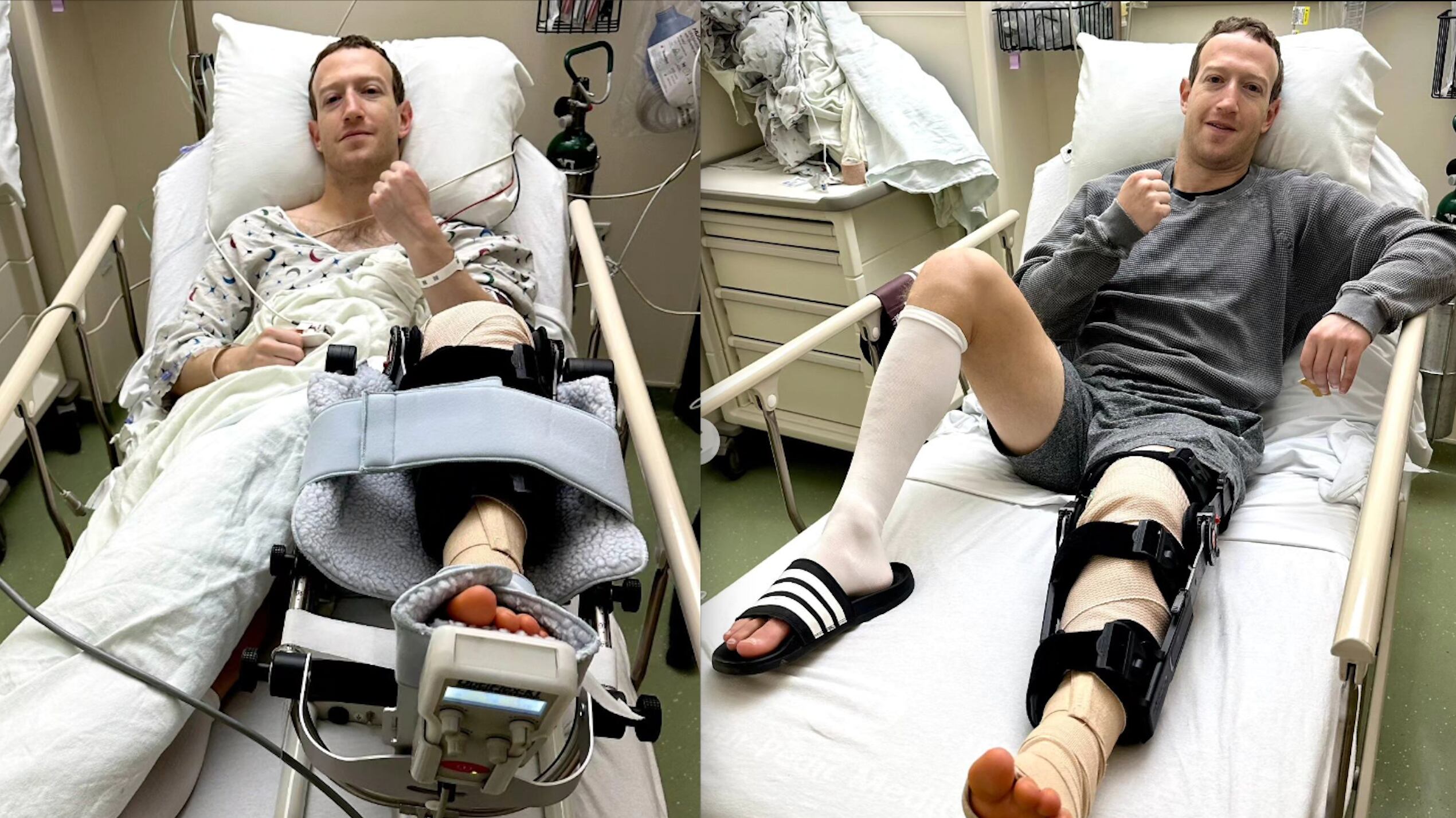 "Troppe botte", Mark Zuckerberg ricoverato in ospedale. Ecco come sta