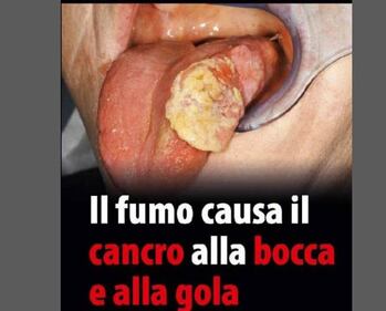 Le foto choc sui pacchetti di sigarette 8