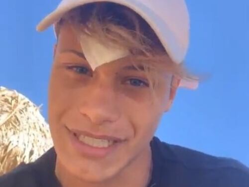 Denis Dosio aggredito, 6 punti per un bicchiere spaccato sulla fronte