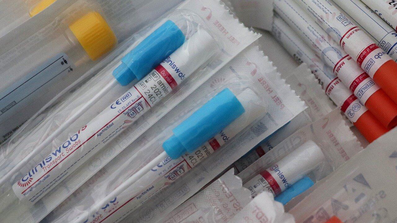 La truffa sui tamponi elaborati coi macchinari che cercano virus animali