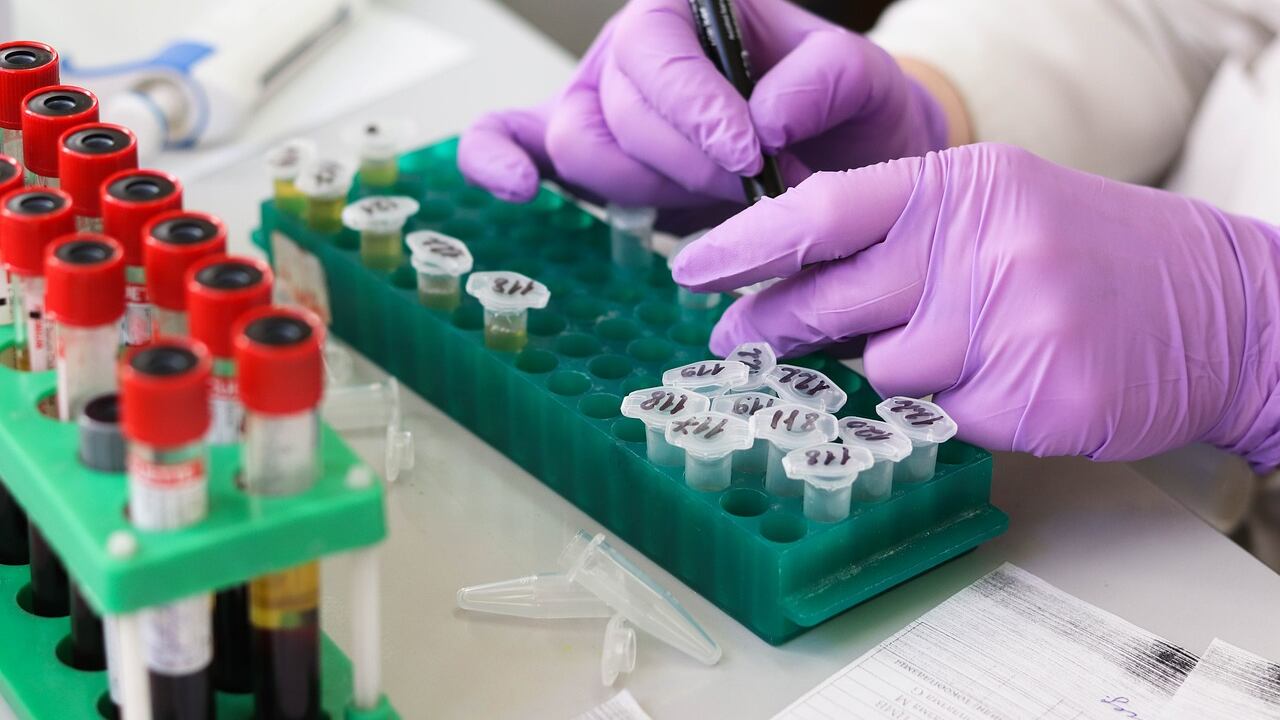 Leucemia mieloide acuta, identificato un nuovo bersaglio genetico