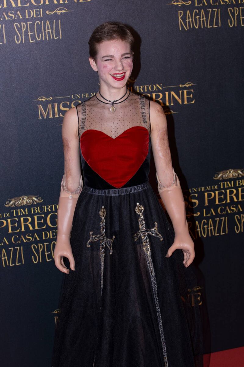 Bebe Vio, dalla medaglia d'oro al jet set 34