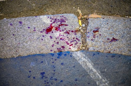 Aggressione a Milano: sei persone ferite, due in modo grave 3