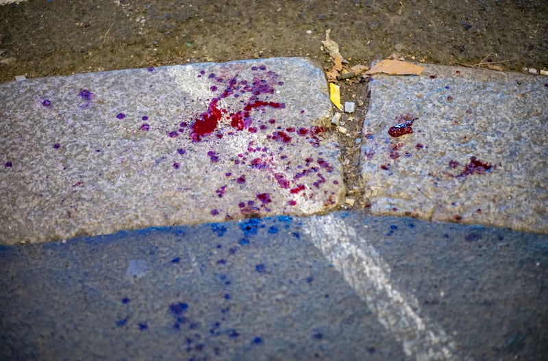 Aggressione a Milano: sei persone ferite, due in modo grave 3