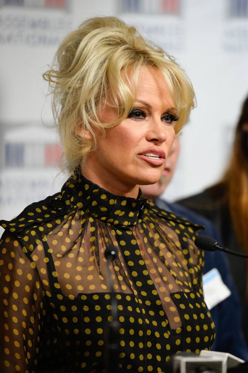 Pamela Anderson contro il foie gras 34