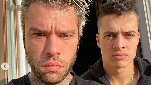 Fedez è tornato su Instagram, ma sembra invecchiato