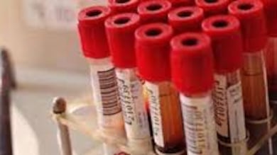 Un test per scoprire il cancro «Bastano» le analisi del sangue