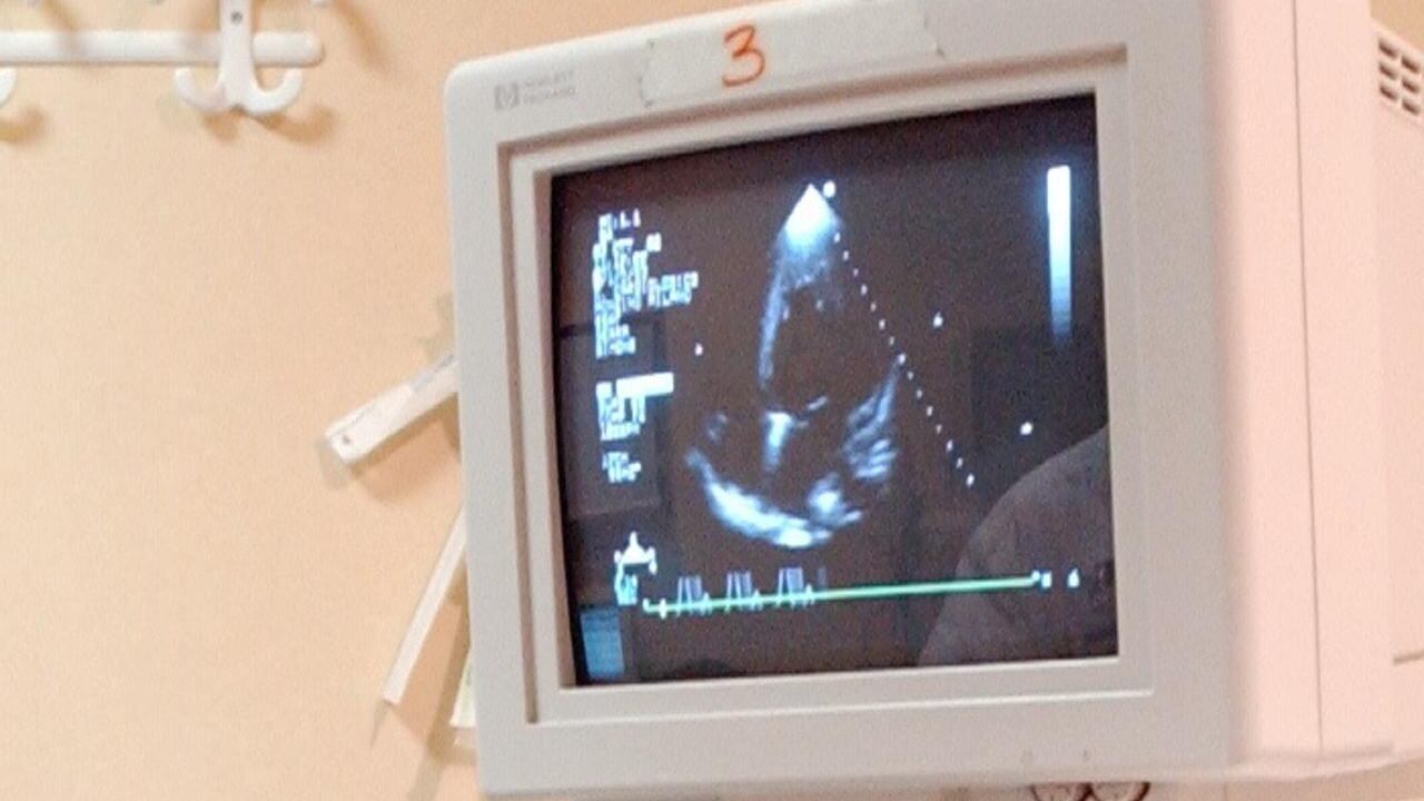 Giornata del cuore, cardiologi lanciano primo Piano strategico nazionale