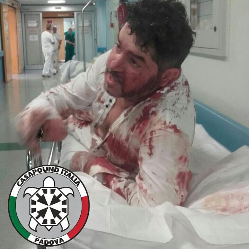 aggredito padova 1