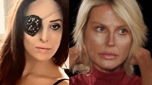 Gessica Notaro preoccupata per la Caldonazzo: "Ho un occhio solo ma certe cose le vedo da lontano"