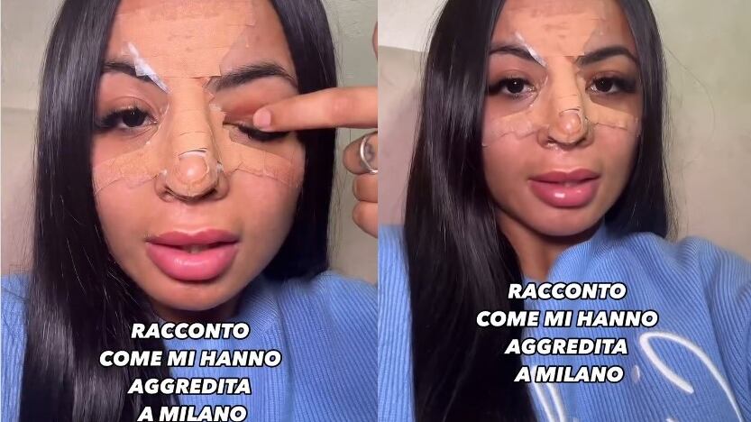 Onlyfanser aggredita a Milano da due ragazzini: presa a calci per aver negato un selfie
