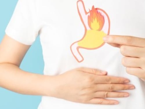 Reflusso gastroesofageo: come si diagnostica e quali esami possono essere utili