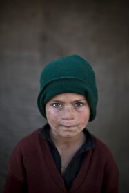 I bambini afghani profughi in Pakistan 2