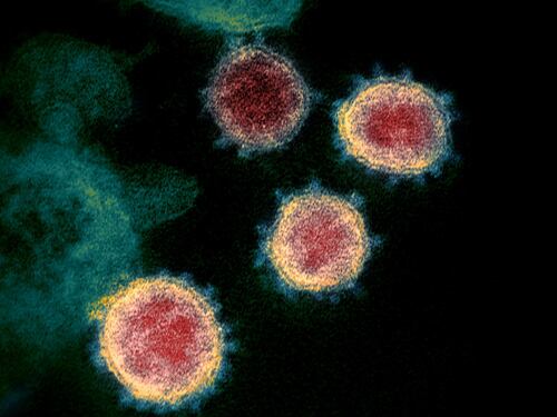 Dalle suole delle scarpe agli alimenti: occhio alle bufale sul coronavirus