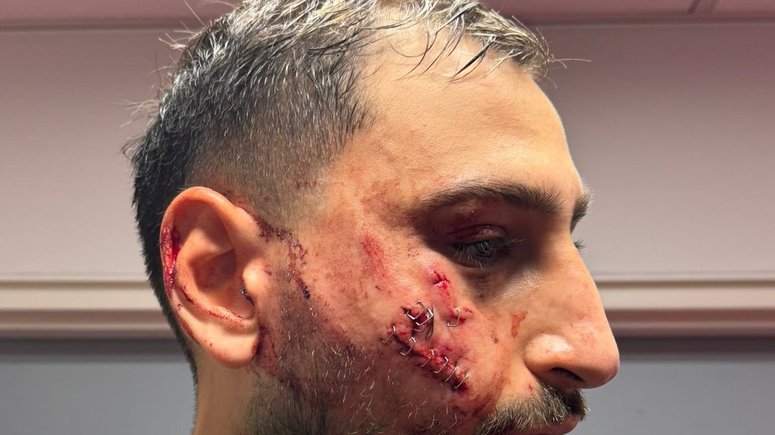 Gigio, 10 e lode. Il calcio isterico impari dal suo fair play