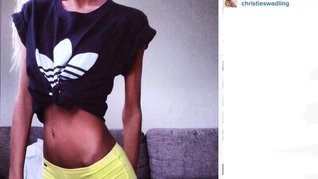 Smette di mangiare per diventare modella