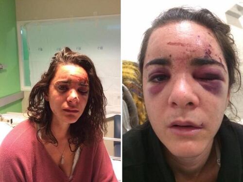 Andrea Sicignano: "Sono stata violentata. Adesso racconto tutto"
