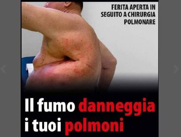 Le foto choc sui pacchetti di sigarette 3