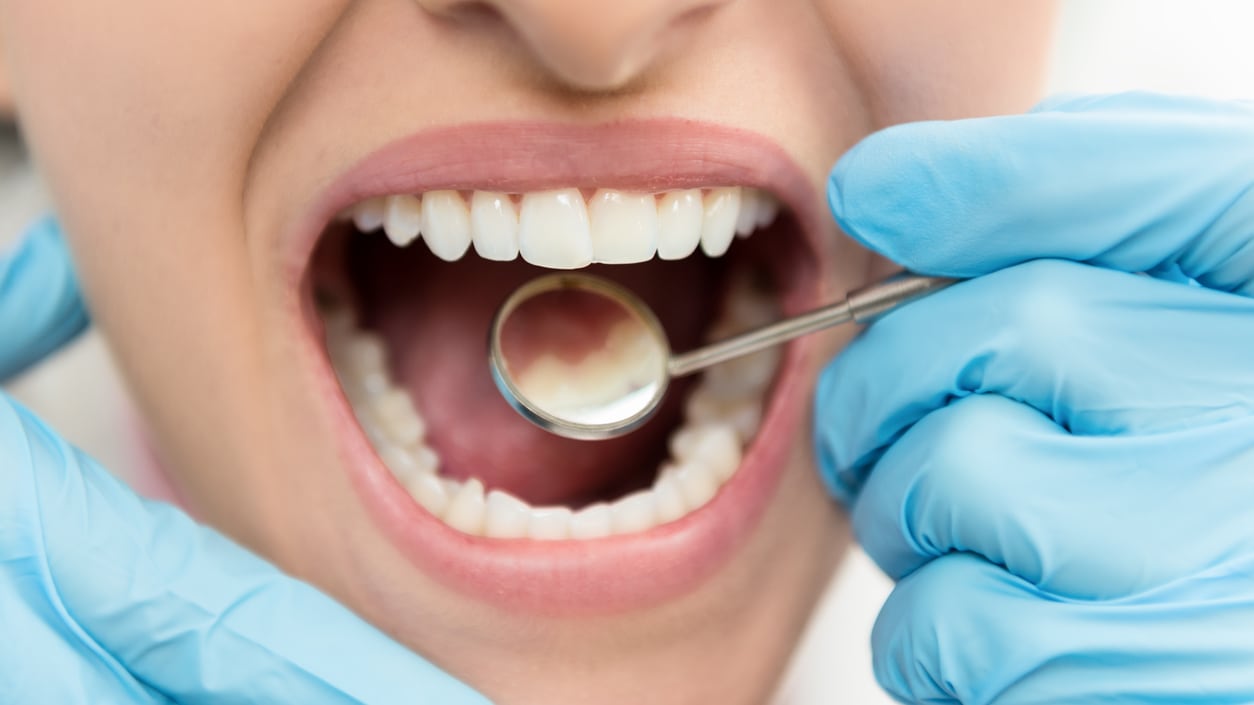 Un problema dentale può essere spia di altre patologie?