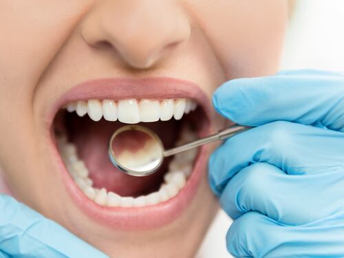Un problema dentale può essere spia di altre patologie?