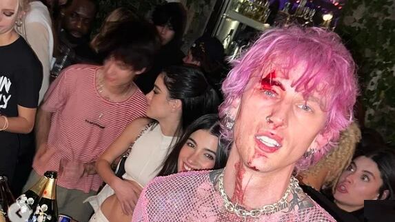 Si spacca un bicchiere di vetro in testa e continua a cantare. La follia di Machine Gun Kelly