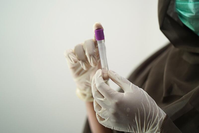 Analisi del sangue