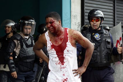 Duri scontri in Venezuela 10