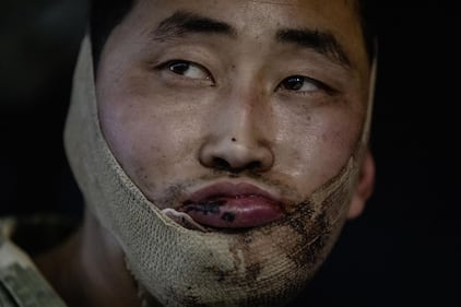 Le foto dei due soldati coreani catturati dagli ucraini 1